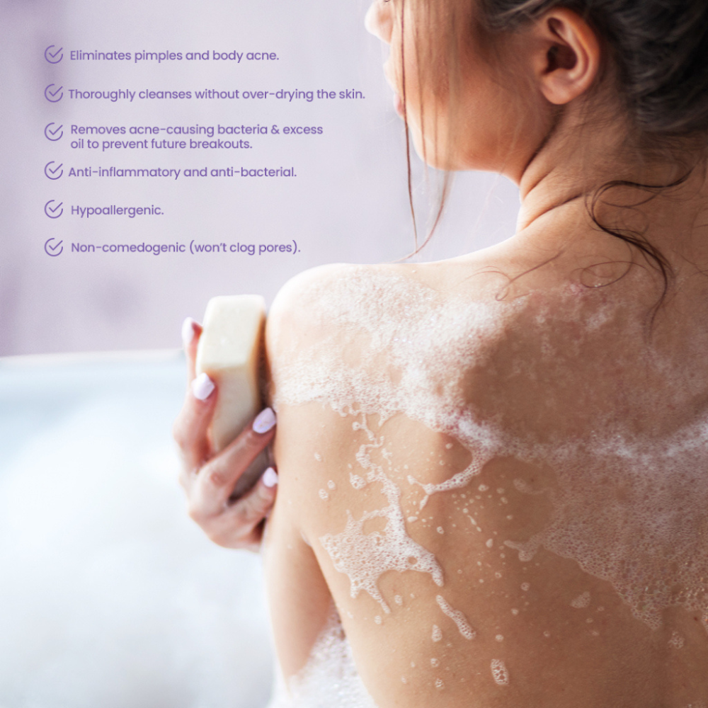 Belo AcnePro Pimple-Fighting Bar -2 Bars x 65g