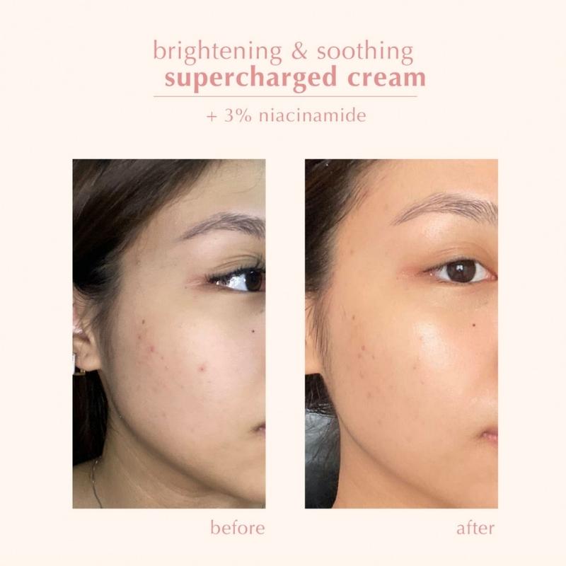 Blk Skin Supercharged Cream + 3% Niacinamide