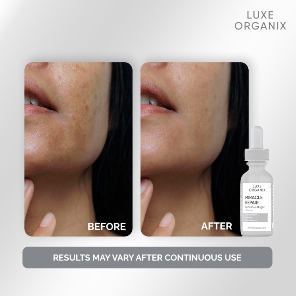 Luxe Organix Miracle Repair Luminous Bright Serum 30ml