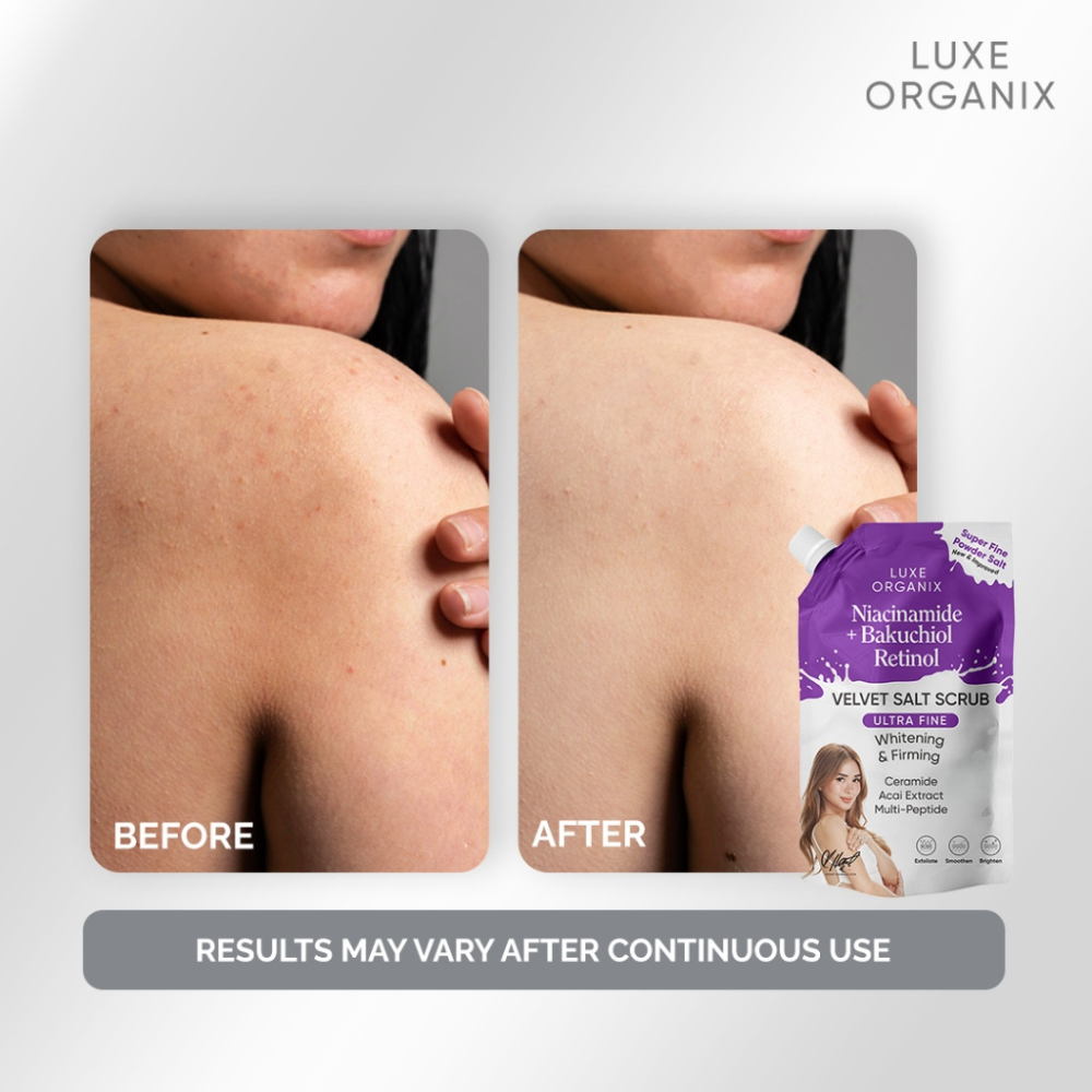 Before and after comparison of a person's skin with Luxe Organix product. Luxe Organix Niacinamide + Bakuchiol Retinol 3x Whitening & Firming Velvet Salt Scrub 300g