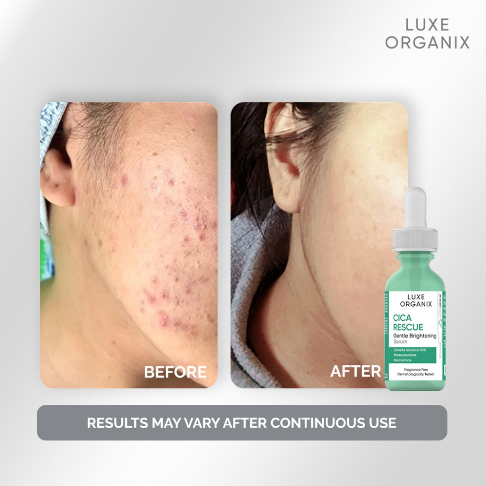 Cica Rescue Gentle Brightening Serum 30ml