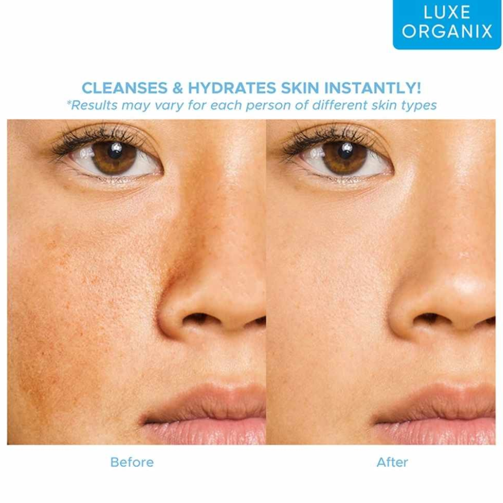 Before and after comparison of skin cleansing with Luxe Organix, showing a clear improvement.Luxe Organix Aqua Lock HyaGlow Essence Toner 150ml