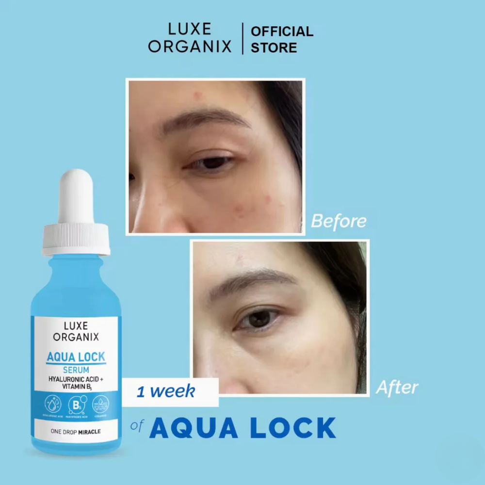 Luxe Organix Aqua Lock serum bottle with 'Before' and 'After' skin comparison on a blue background Luxe Organix Aqua Lock HyaGlow White 2x Boost Serum 30ml