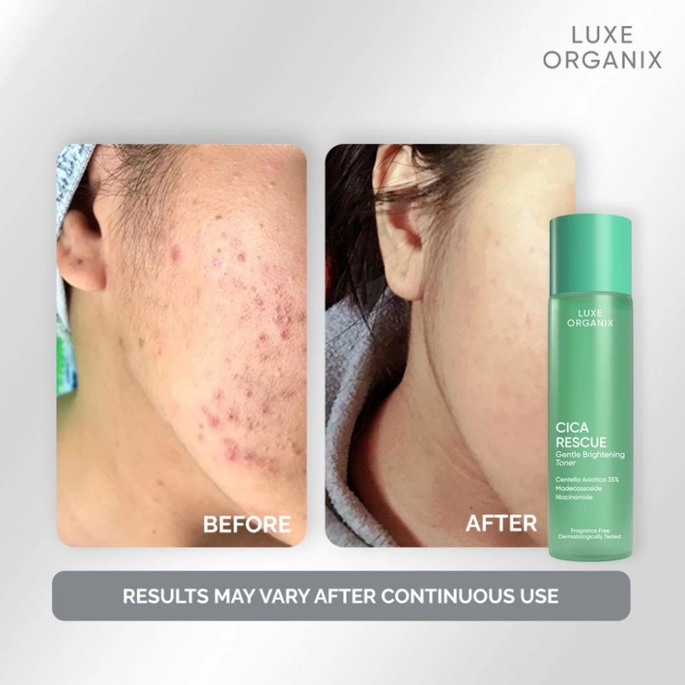 Cica Rescue Gentle Brightening Toner 150ml