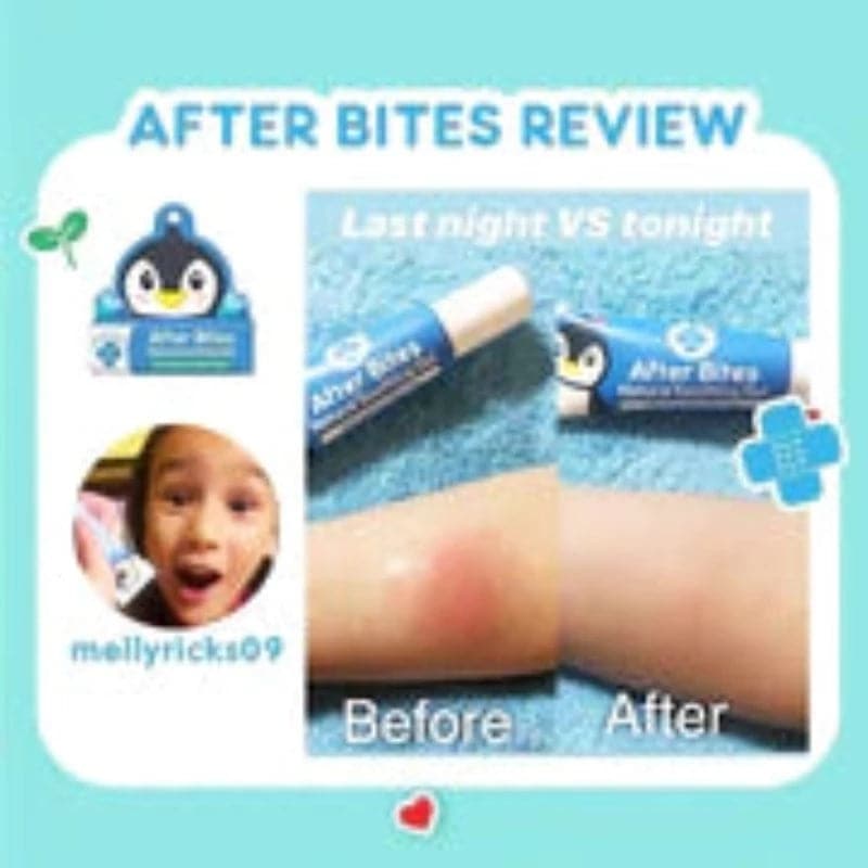 Tiny Buds AFTER BITES SOOTHING GEL - Insect Bites
