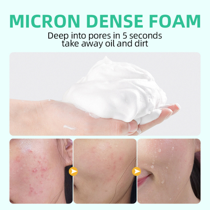 Amino Acid Whitening Cleansing Foam 500ml