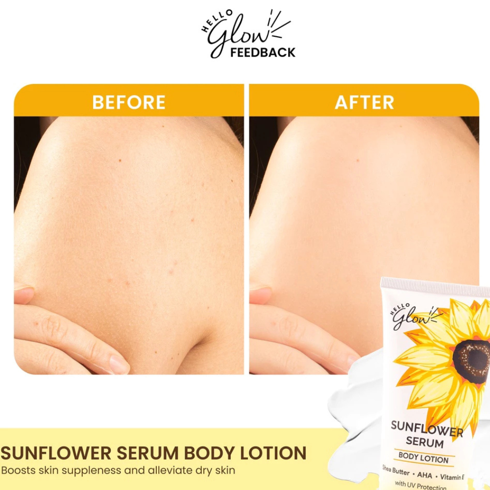 Before and after comparison of sunflower serum body lotion on skin with product packaging. Hello Glow Sunflower Serum Body Lotion with UV Protection 200ml