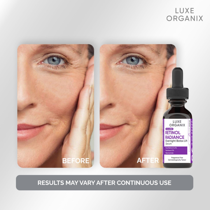 Luxe Organix ClinicalPro Retinol Radiance Overnight Botox Lift Serum 30ml