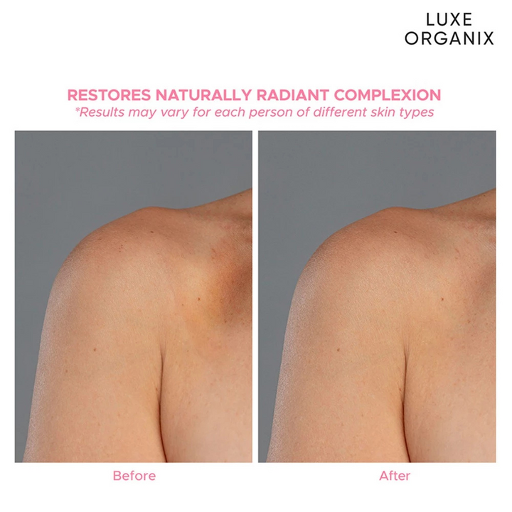 Luxe ORganix Niacinamide + Alpha Arbutin Healthy Light Whitening Serum Lotion 350ml