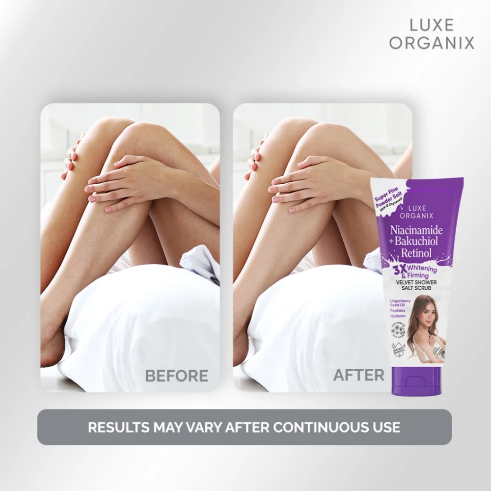 Before and after comparison of legs with Luxe Organix product showing results. Luxe Organix Niacinamide + Bakuchiol Retinol 3x Whitening & Firming Velvet Shower Salt Scrub