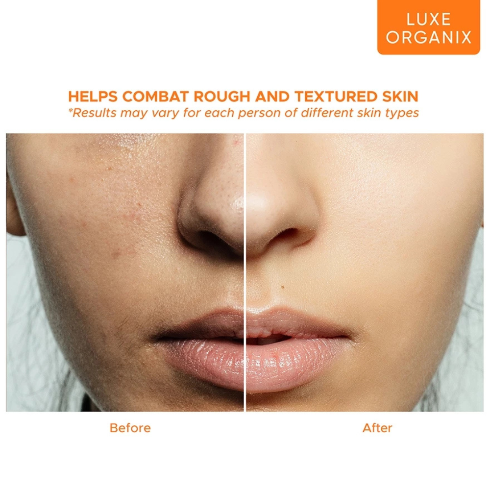 Luxe Organix ClinicalPRO Vita C20 Booster Serum — 7ml Sachet 