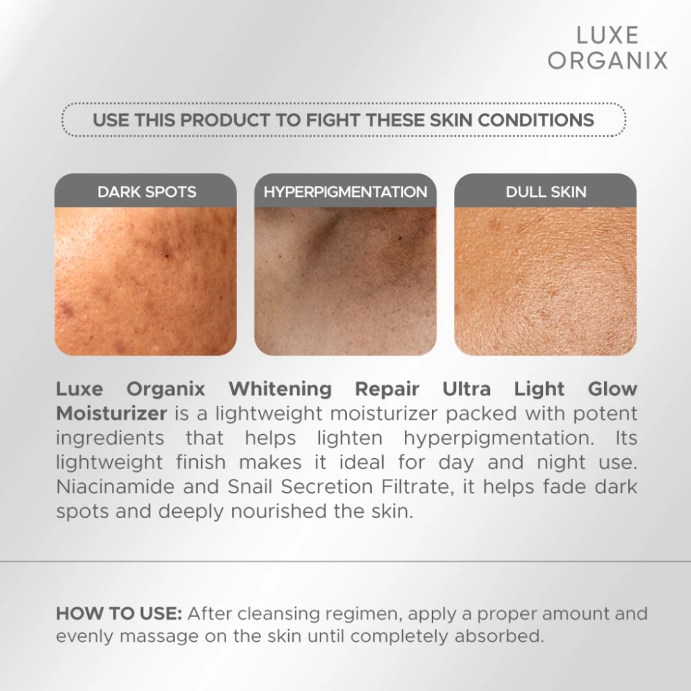 Advertisement for Luxe Organix skincare product targeting dark spots, hyperpigmentation, and dull skin. Luxe Organix Whitening Repair Ultra Light Glow Moisturizer 80ml