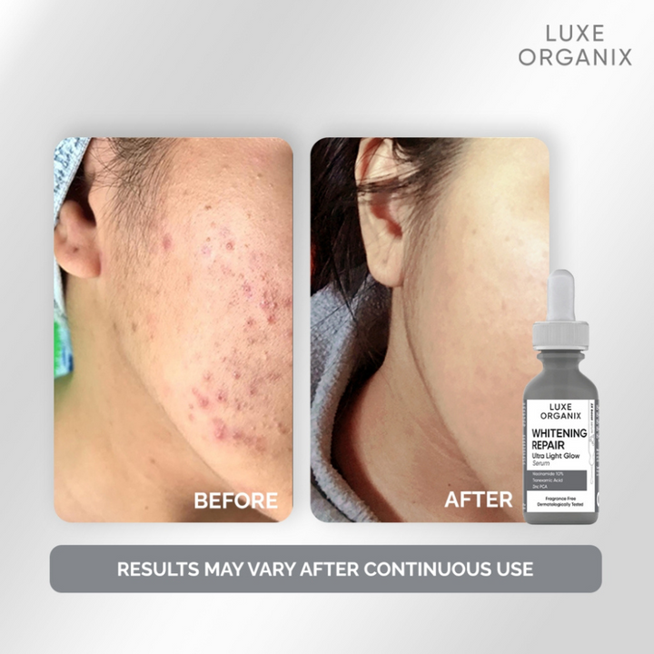 Luxe Organix ClinicalPro Whitening Repair Ulta Light Glow Serum 30ml