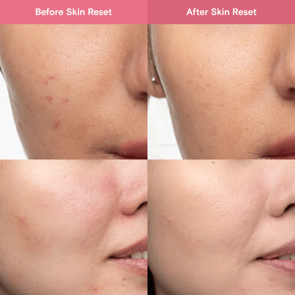 blk skin Skin Reset - Hypochlorous Acid Redness Reducing Facial Spray 