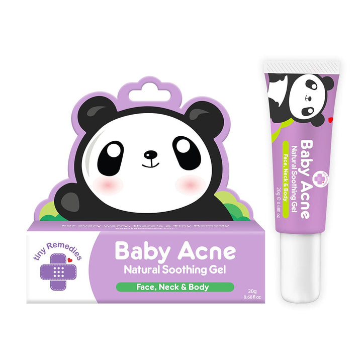 Tiny Buds Baby Acne Natural Soothing Gel