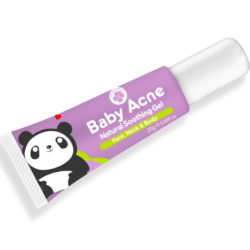 Tiny Buds Baby Acne Natural Soothing Gel