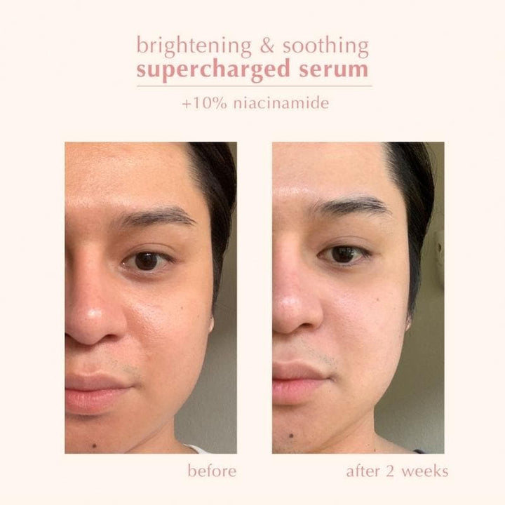 blk skin Brightening and Soothing Supercharged Serum + Niacinamide