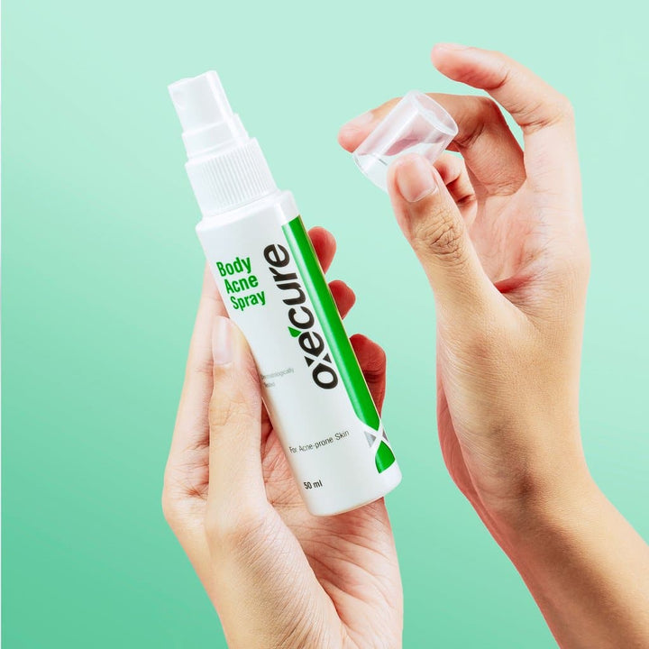 Oxecure Body Acne Spray 25ml Alden Richards