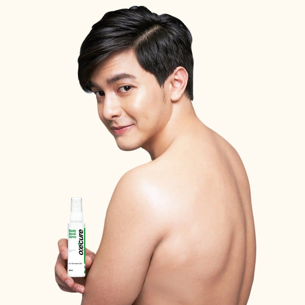 Oxecure Body Acne Spray 25ml Alden Richards